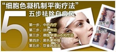 温州治疗白癜风